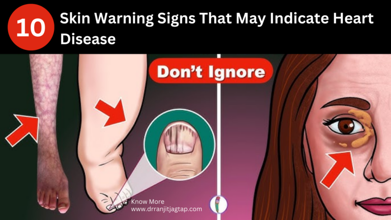 Discover 10 skin signs that could point to heart disease, from cyanosis to xanthomas. Recognize these symptoms and protect your heart health.